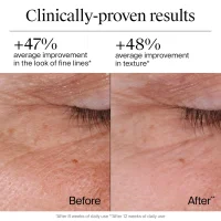 Neutrogena Rapid Wrinkle Repair Retinol Moisturizer, 1.7 oz – product image 2